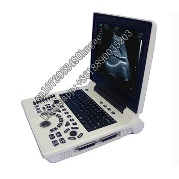 Цена цветного допплерографа E20 Портативные ультразвуковые сканеры для беременных